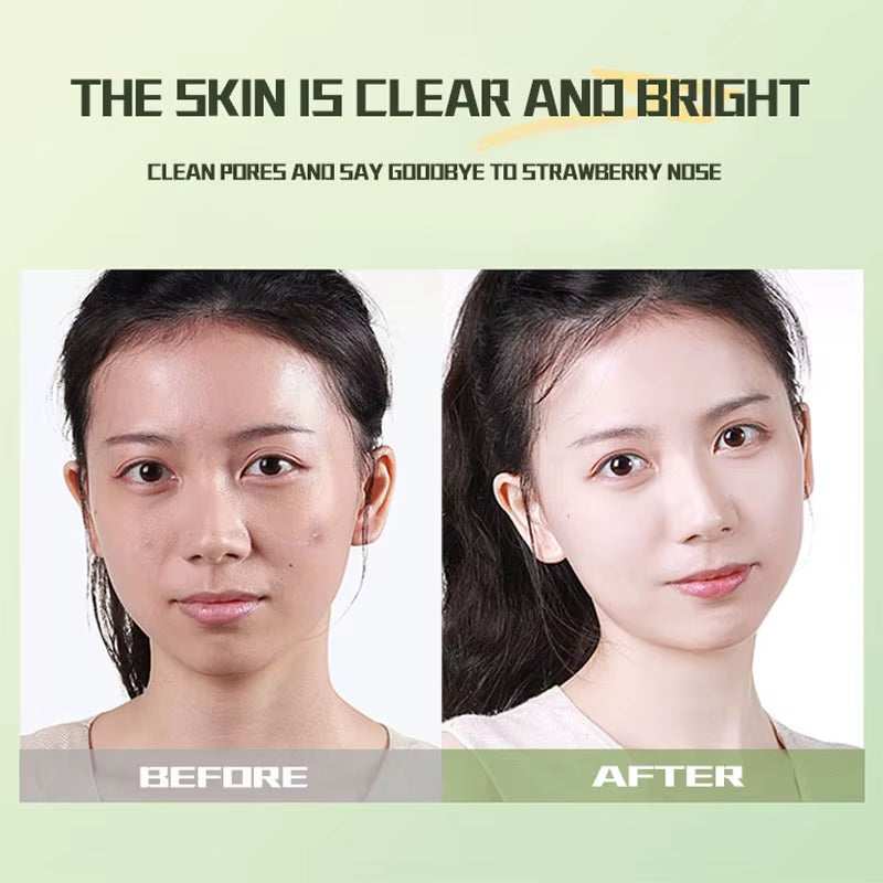 Revitalize Your Skin with Our Green Tea Ice Muscle Mud Mask! 🌿✨ Deep Cleanse, Banish Blackheads, and Minimize Pores for a Flawless Glow! 💚 #SkincareGoals #FaceMaskMagic